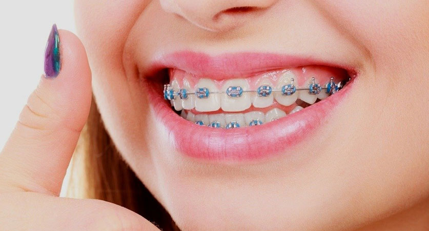 affordable orthodontist