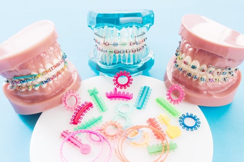 Color Braces