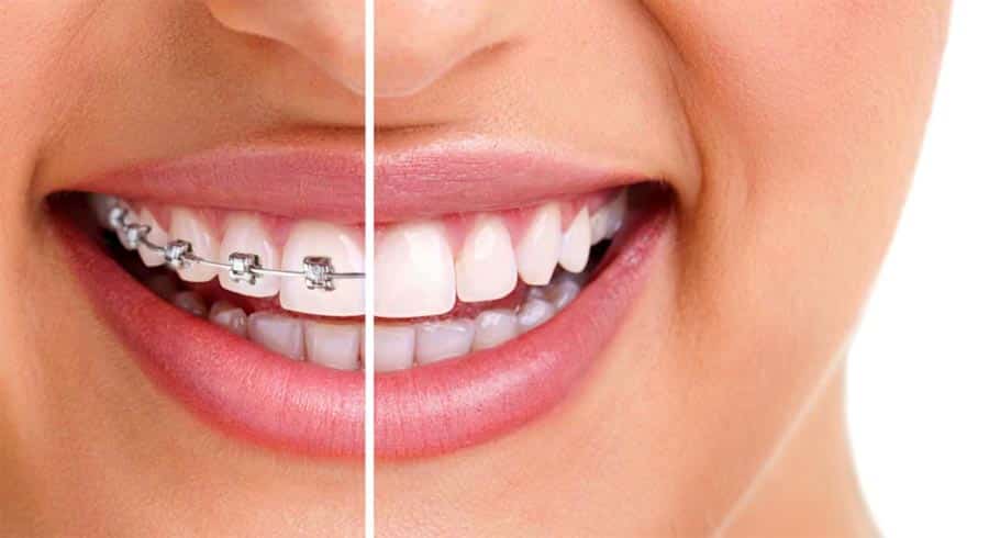 affordable orthodontist near me