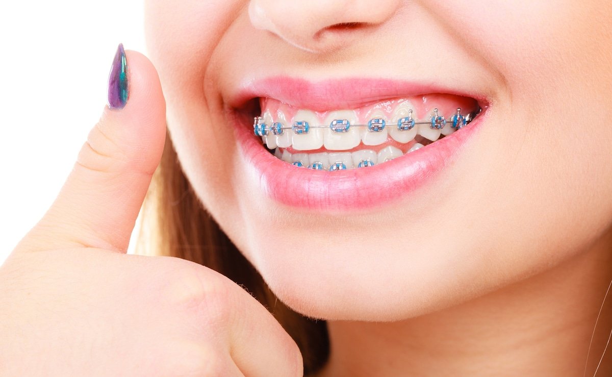 dentist for braces near me